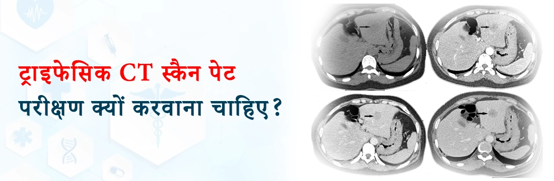 ट्राइफेसिक CT स्कैन पेट: परीक्षण क्यों करवाना चाहिए?